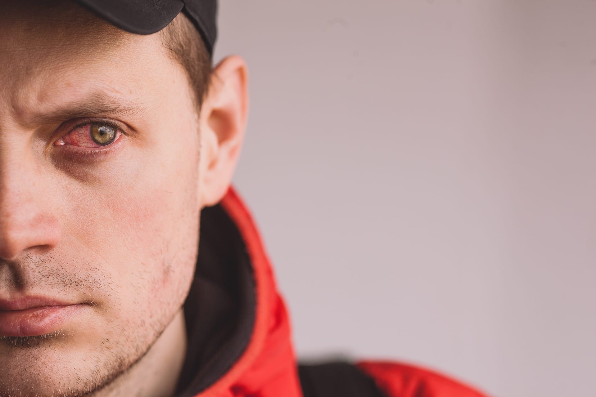 Pessoa com conjuntivite no inverno consultando oftalmologista